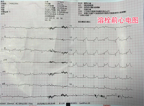 心電圖1_副本.jpg